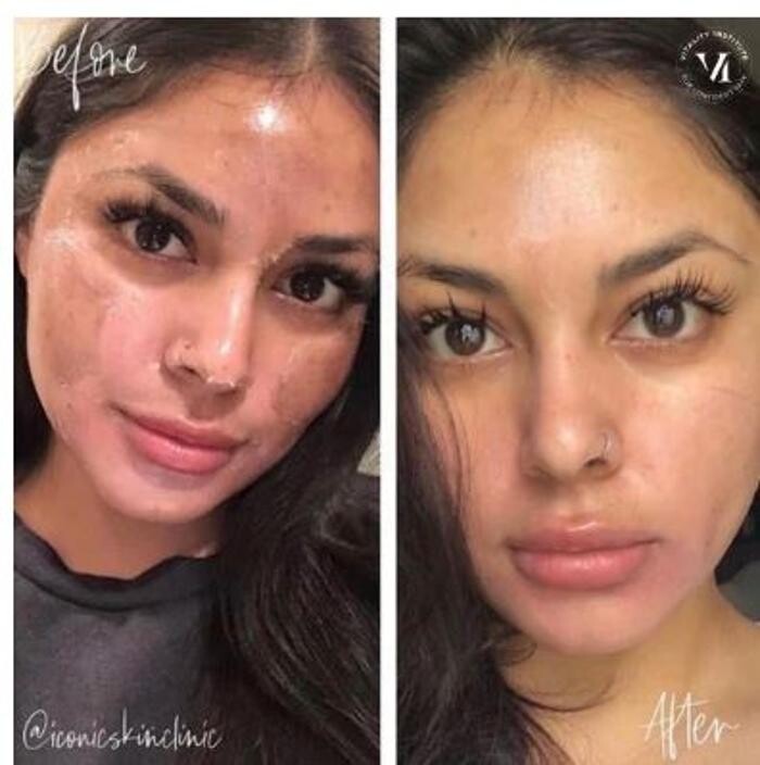 Images Glo Medspa