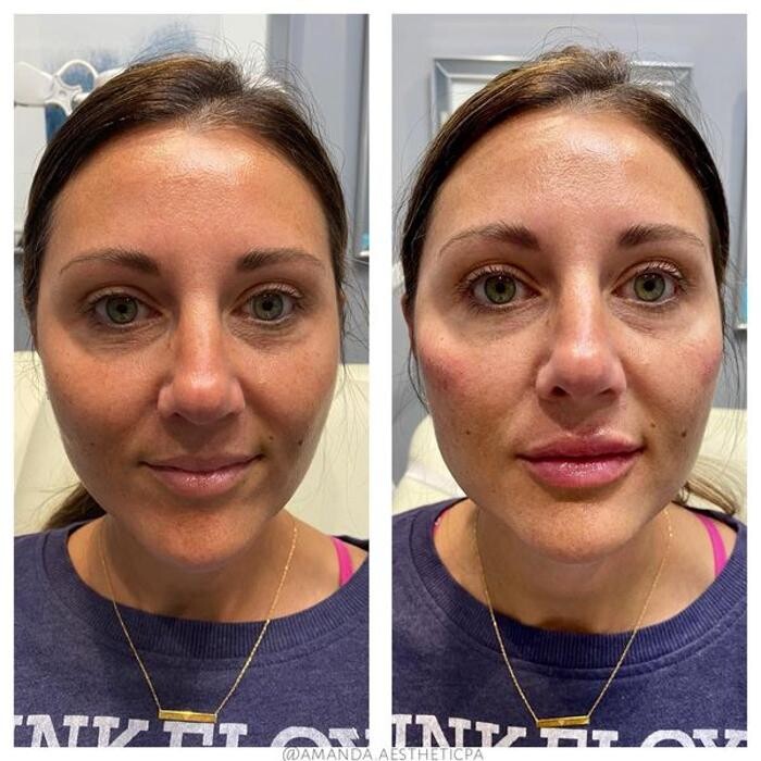 Images Glo Medspa