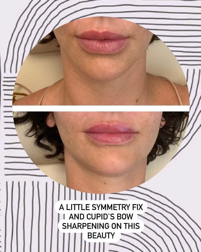 Images Glo Medspa