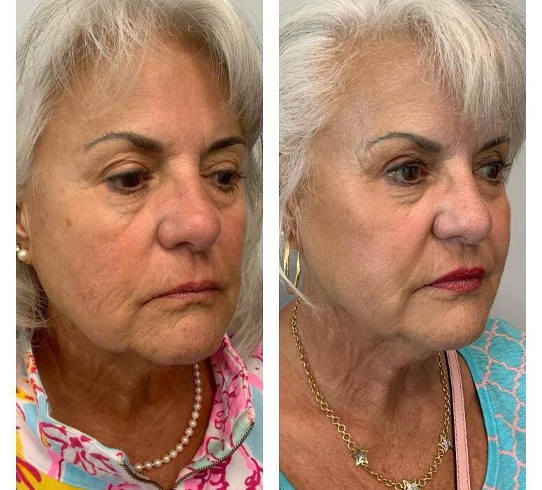 Images Glo Medspa