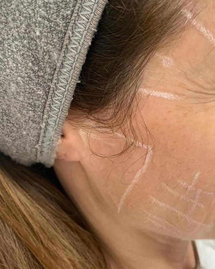 Images Glo Medspa