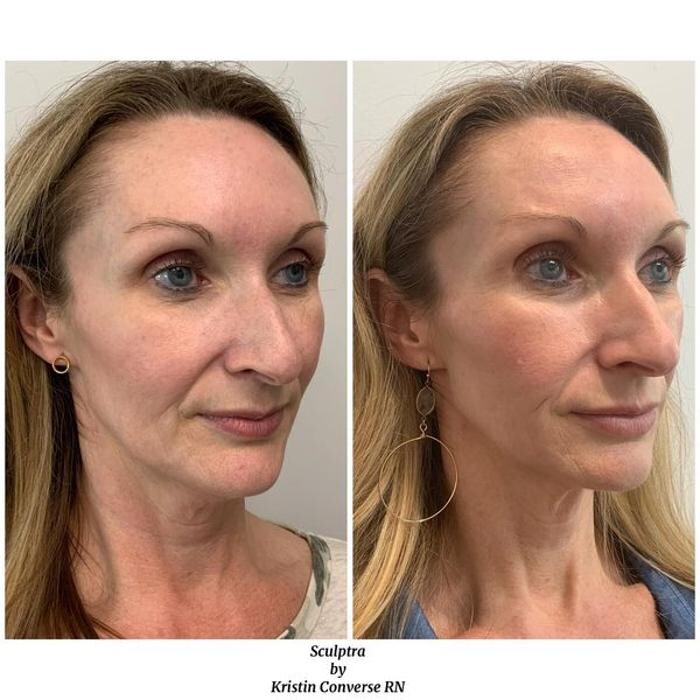 Images Glo Medspa