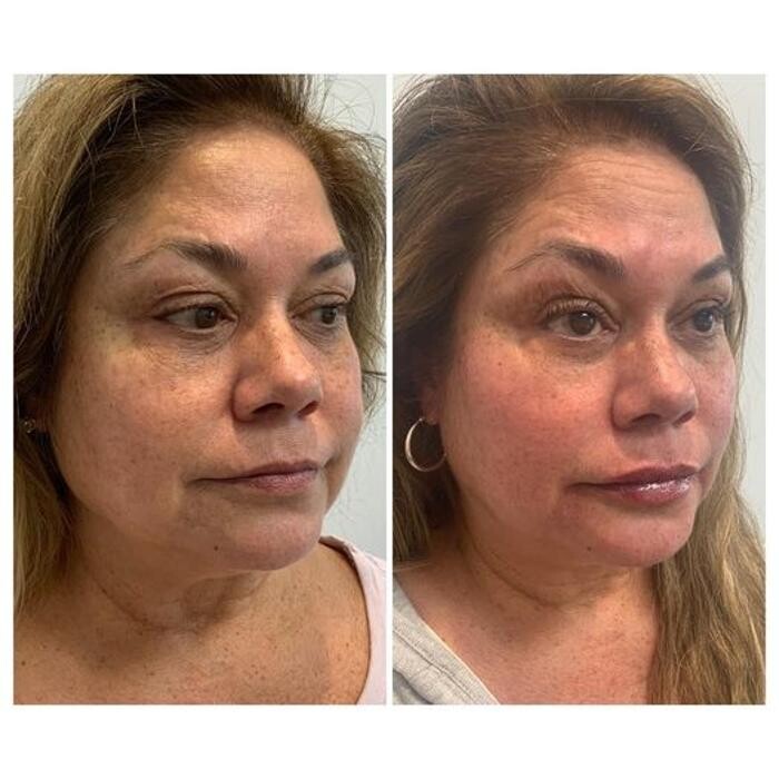 Images Glo Medspa