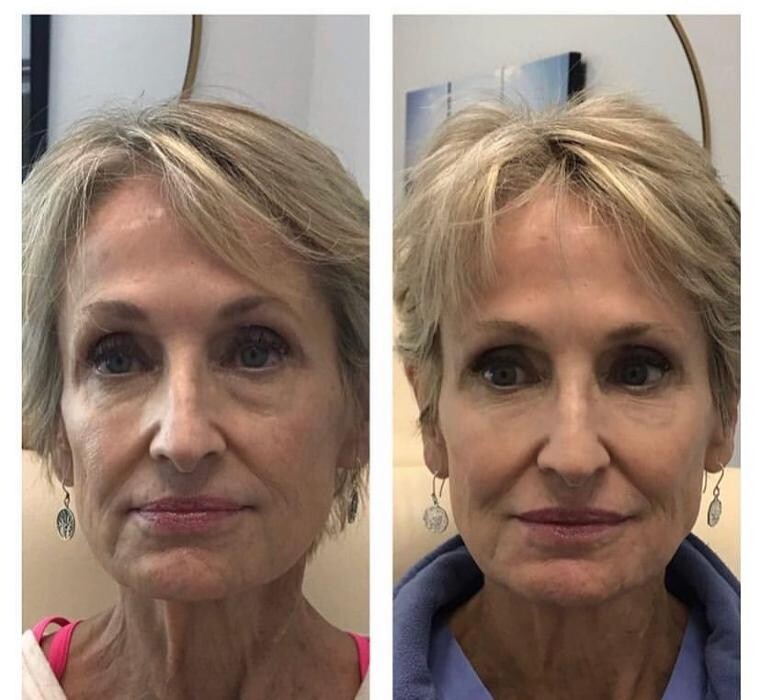 Images Glo Medspa