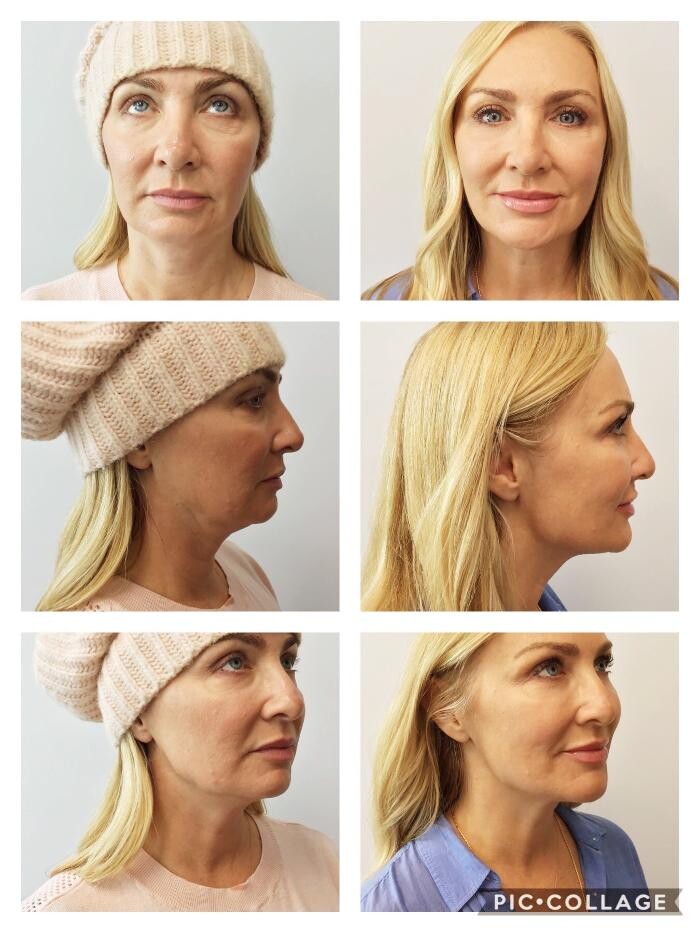 Images Glo Medspa