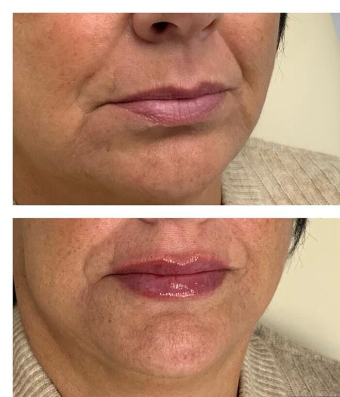 Images Glo Medspa