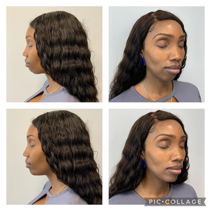 Images Glo Medspa