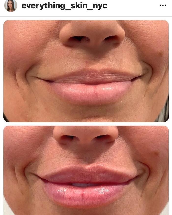 Images Glo Medspa