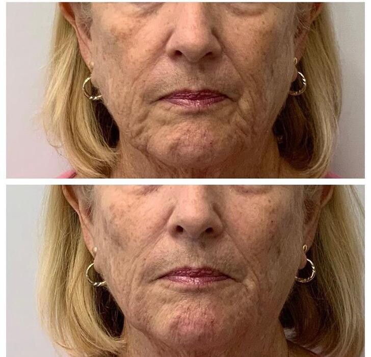 Images Glo Medspa