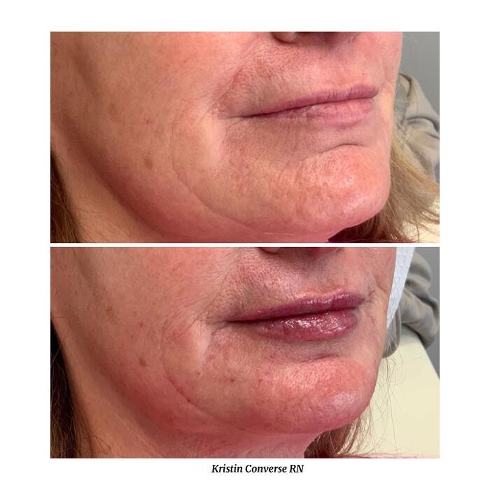 Images Glo Medspa