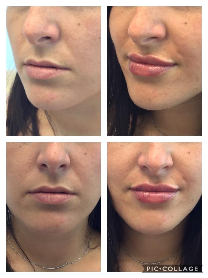 Images Glo Medspa
