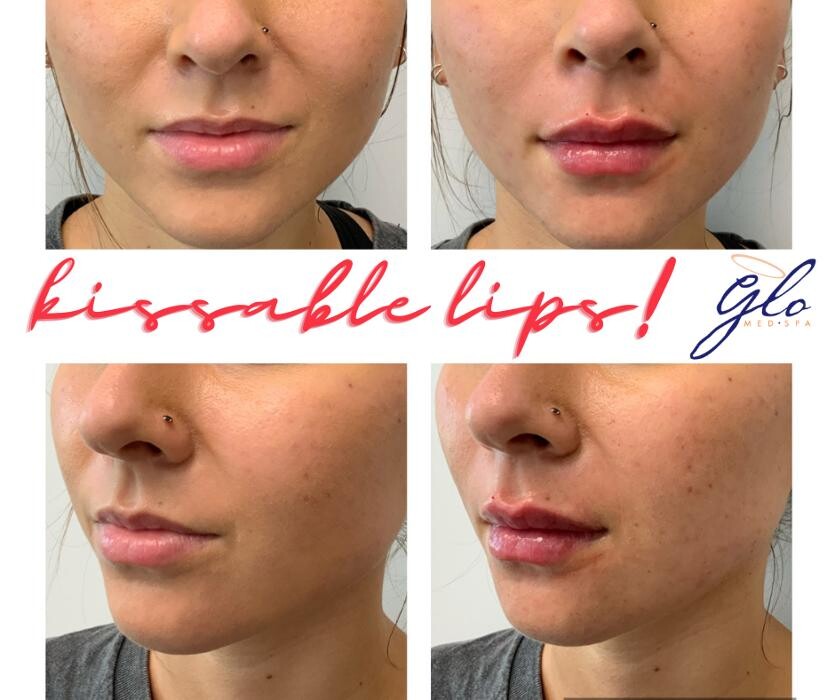 Images Glo Medspa