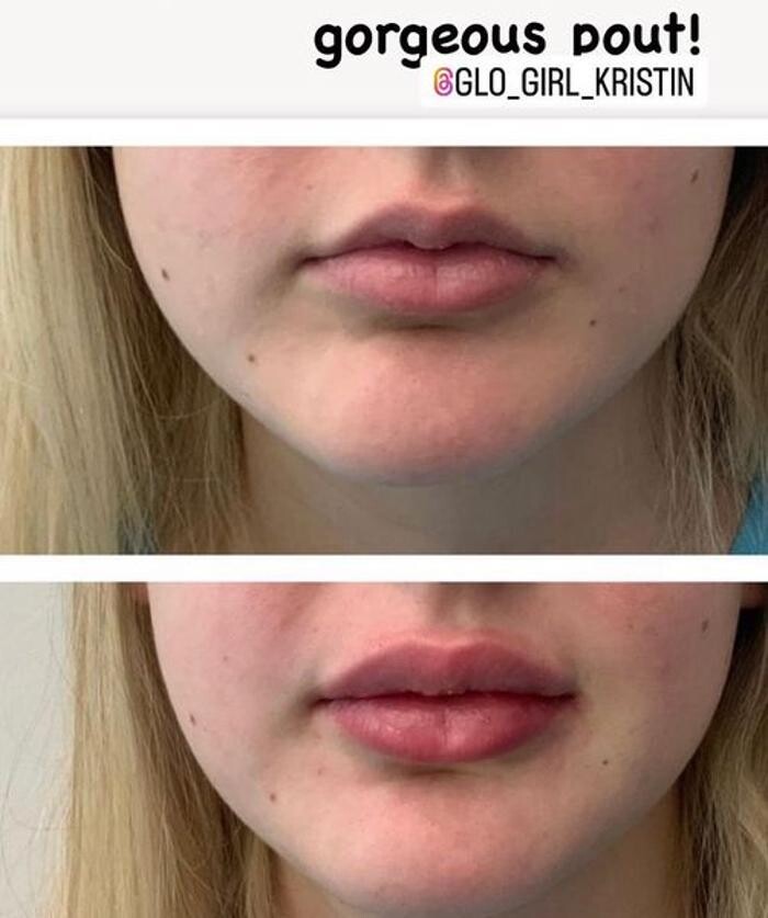 Images Glo Medspa