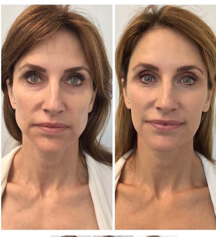 Images Glo Medspa