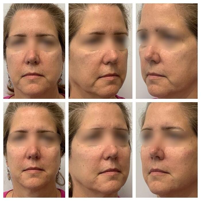 Images Glo Medspa