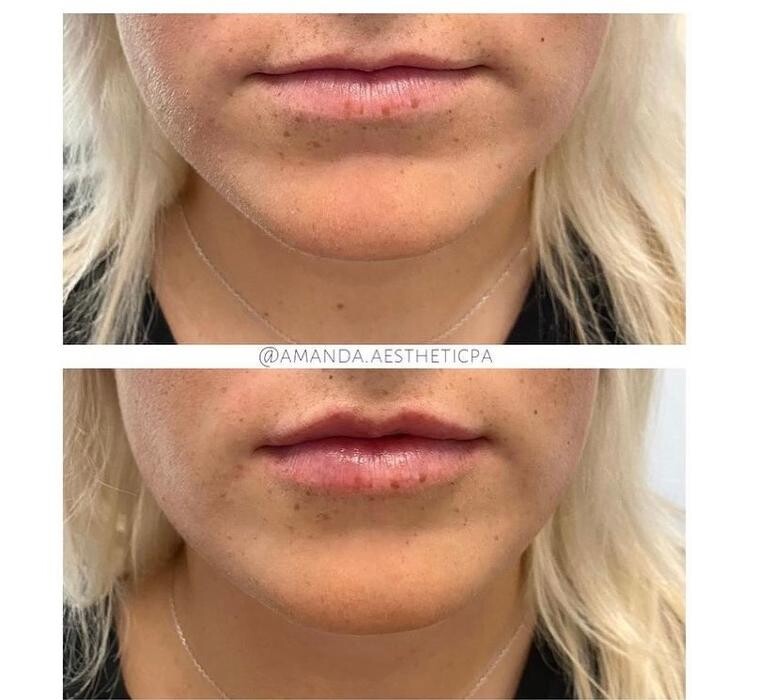 Images Glo Medspa