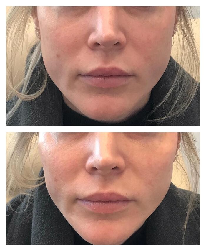 Images Glo Medspa