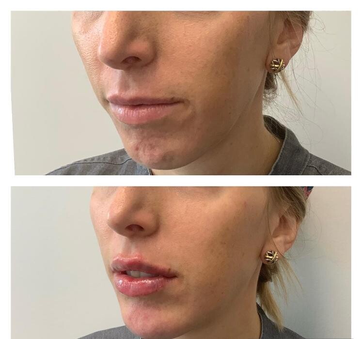 Images Glo Medspa