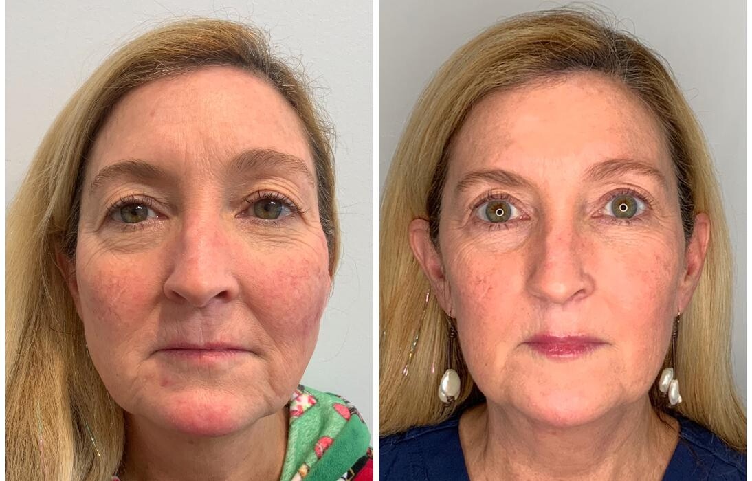Images Glo Medspa