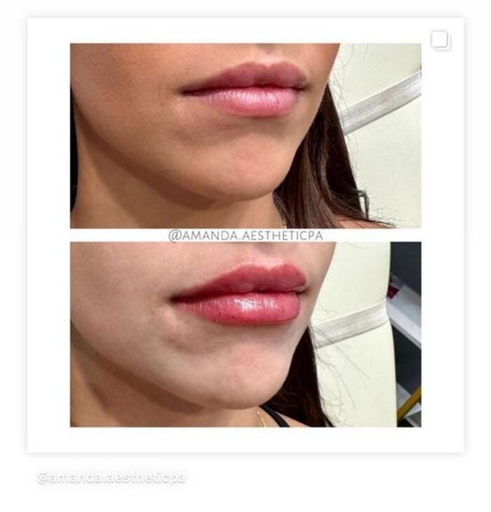 Images Glo Medspa
