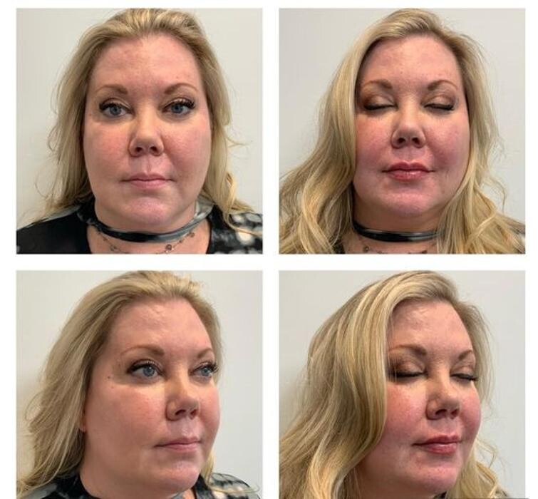 Images Glo Medspa