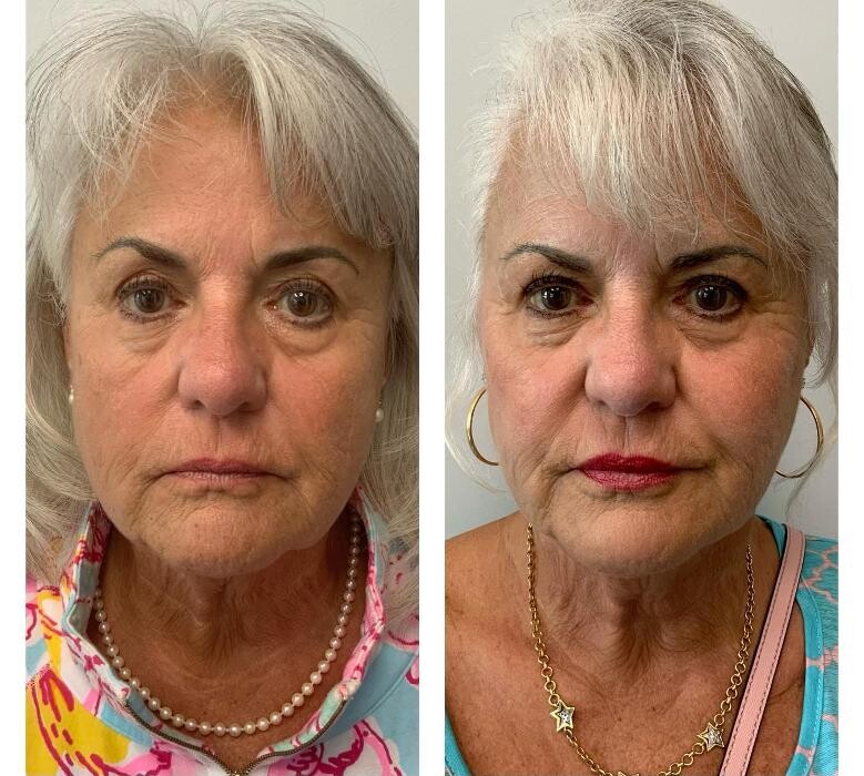 Images Glo Medspa