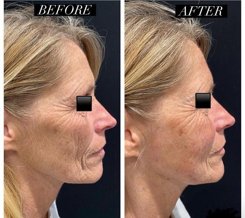 Images Glo Medspa