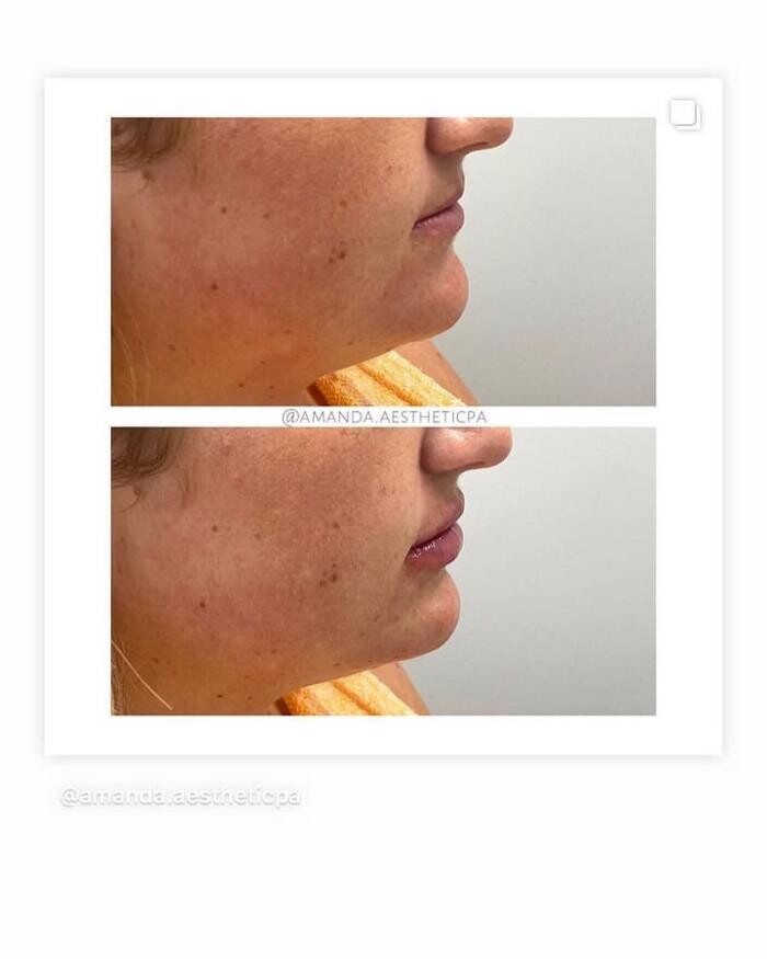 Images Glo Medspa