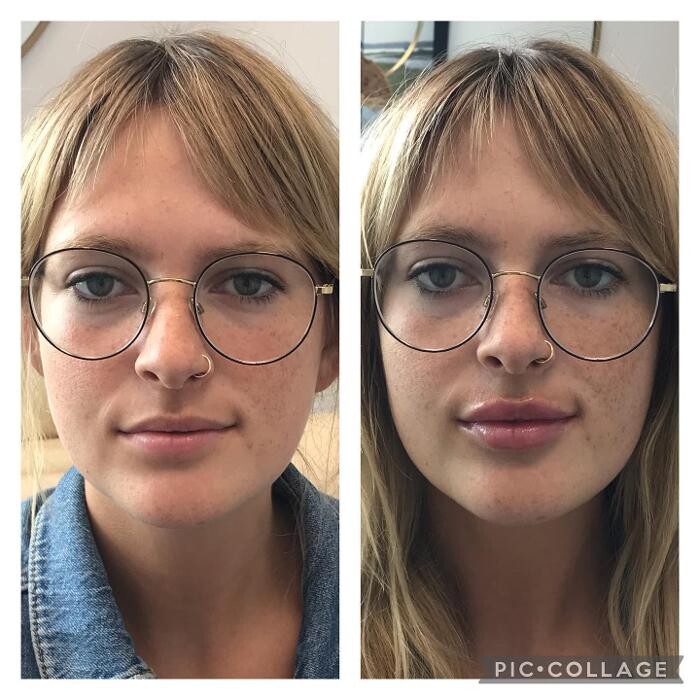 Images Glo Medspa
