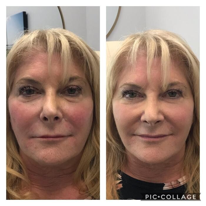 Images Glo Medspa