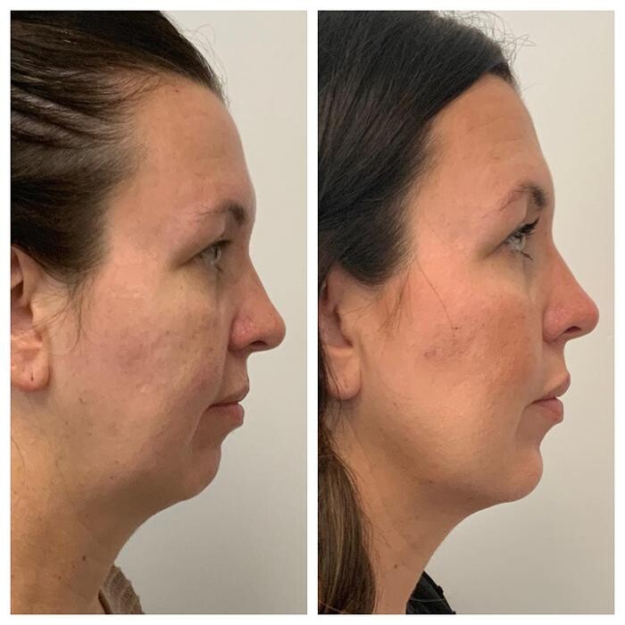 Images Glo Medspa