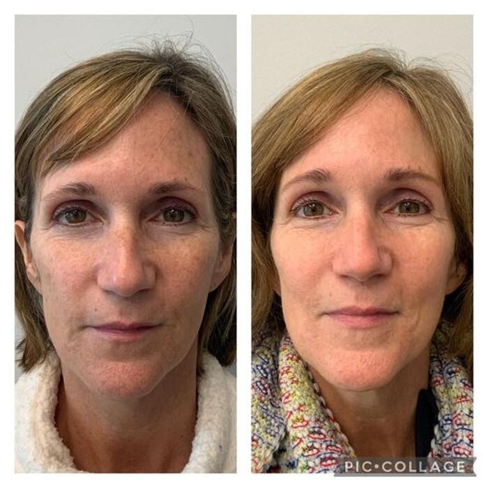 Images Glo Medspa