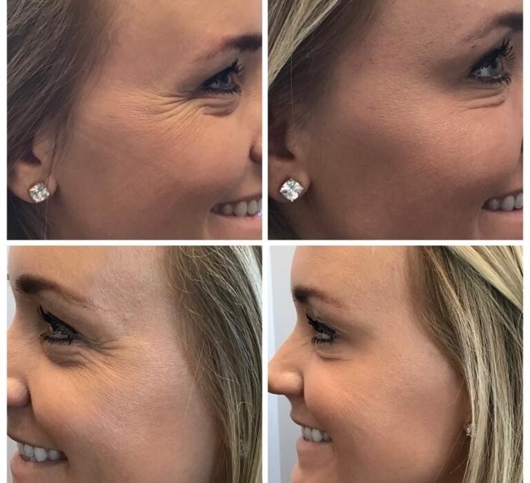Images Glo Medspa