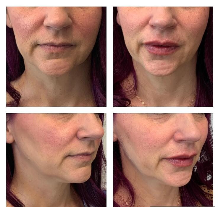 Images Glo Medspa