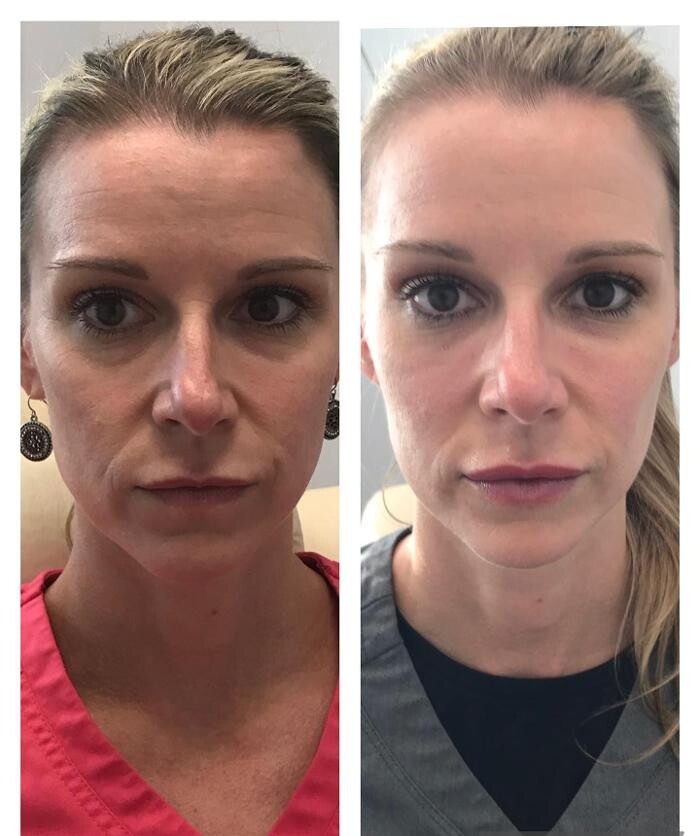 Images Glo Medspa