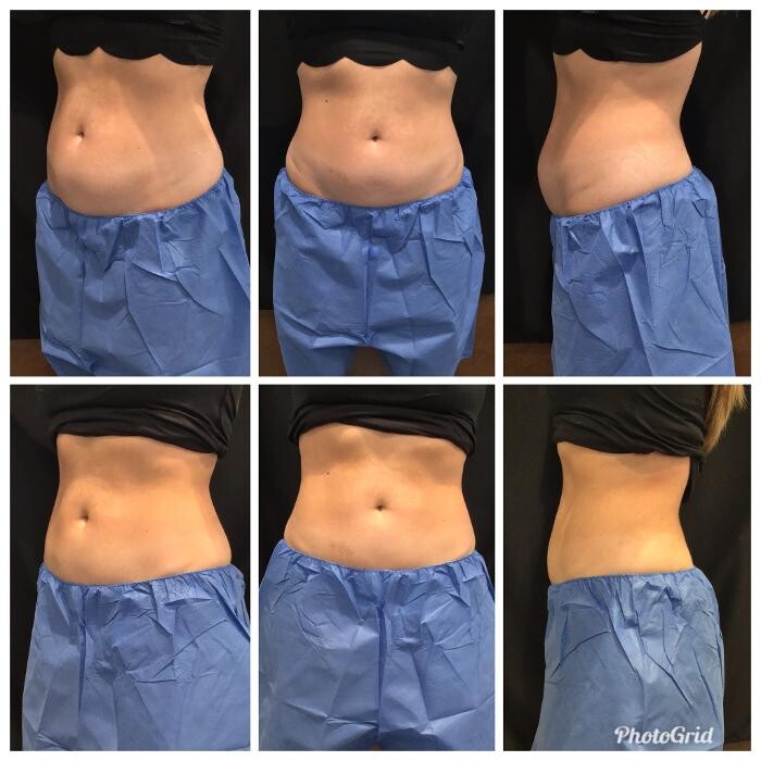 Images Glo Medspa