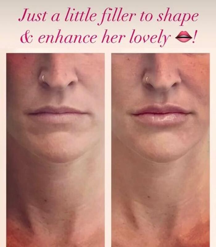 Images Glo Medspa