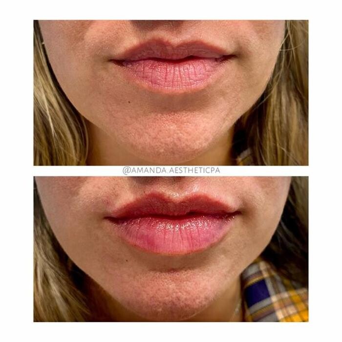 Images Glo Medspa