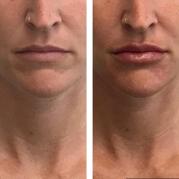 Images Glo Medspa