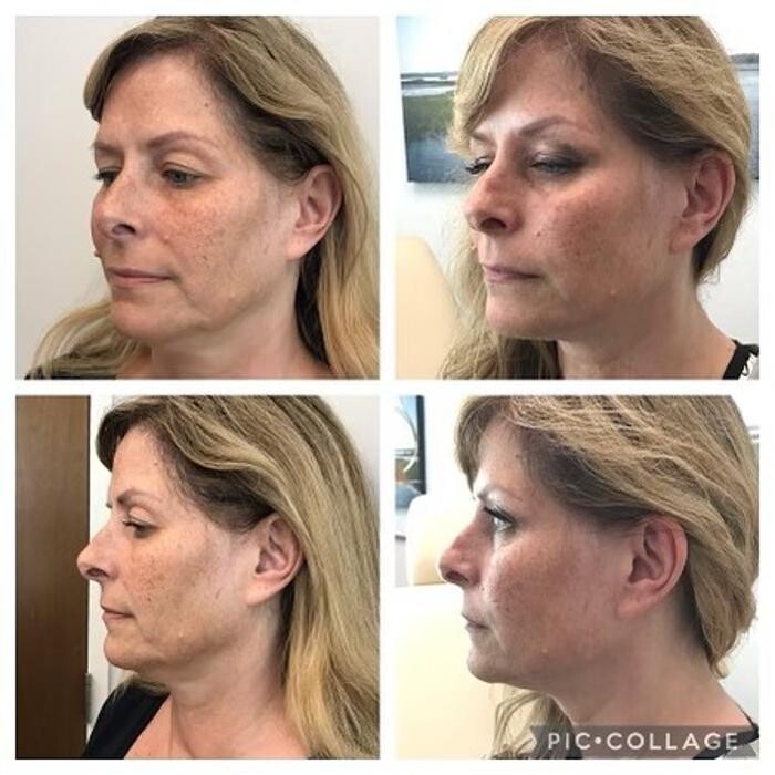 Images Glo Medspa