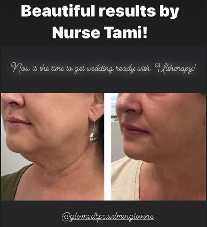 Images Glo Medspa