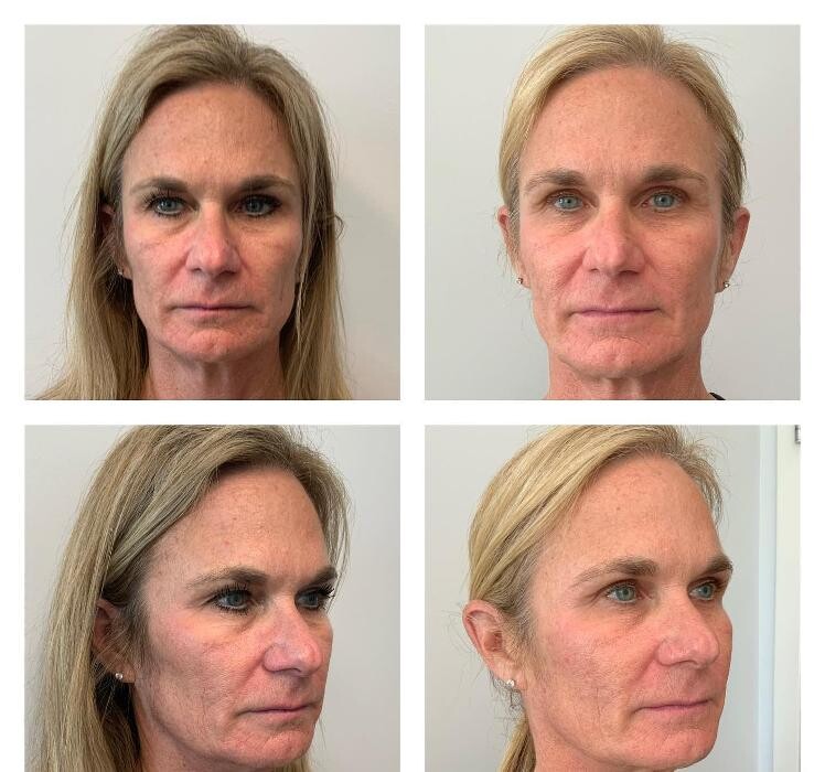Images Glo Medspa