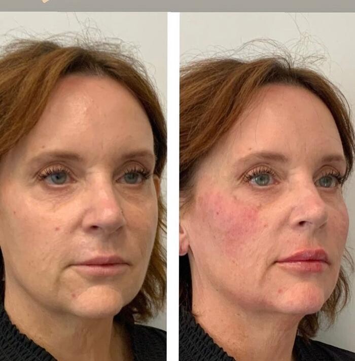 Images Glo Medspa