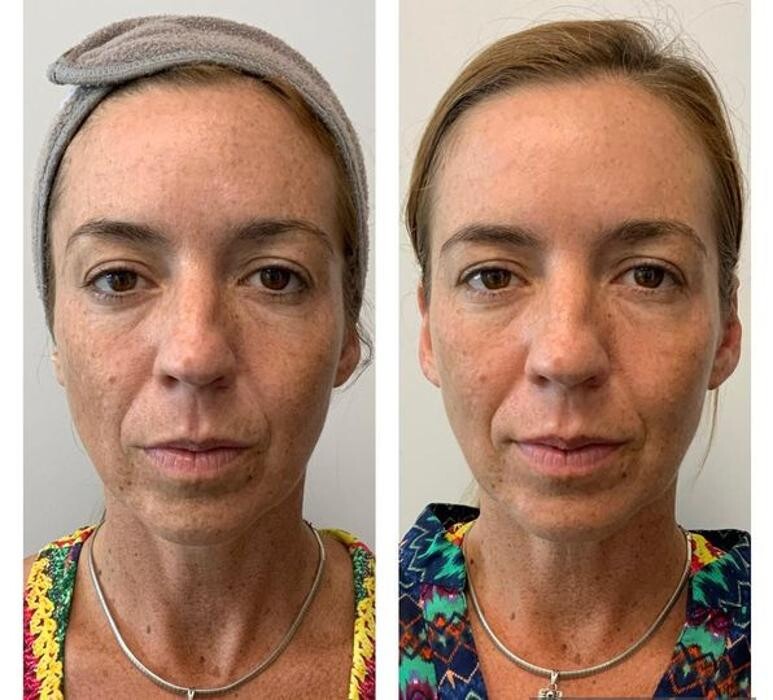 Images Glo Medspa