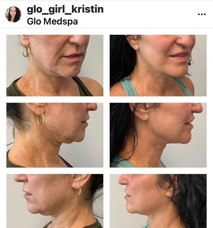 Images Glo Medspa