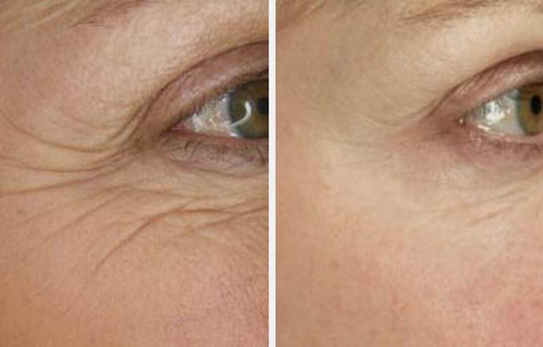 Images Glo Medspa