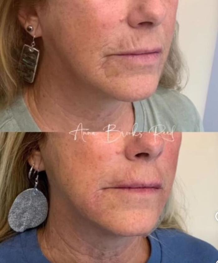 Images Glo Medspa
