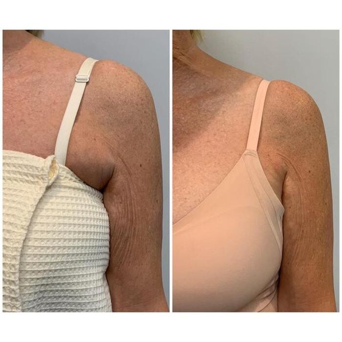 Images Glo Medspa