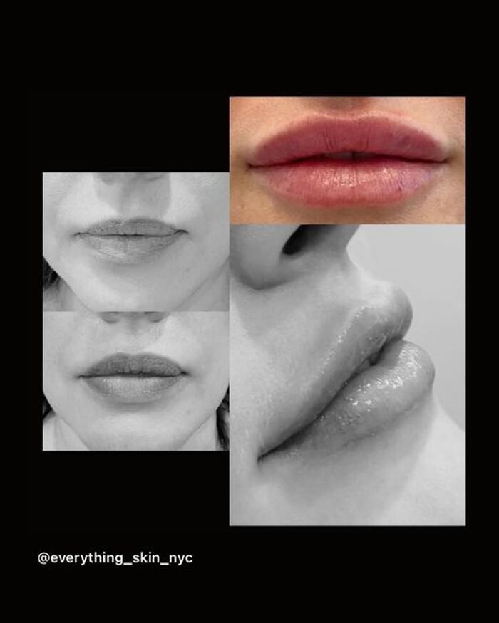 Images Glo Medspa