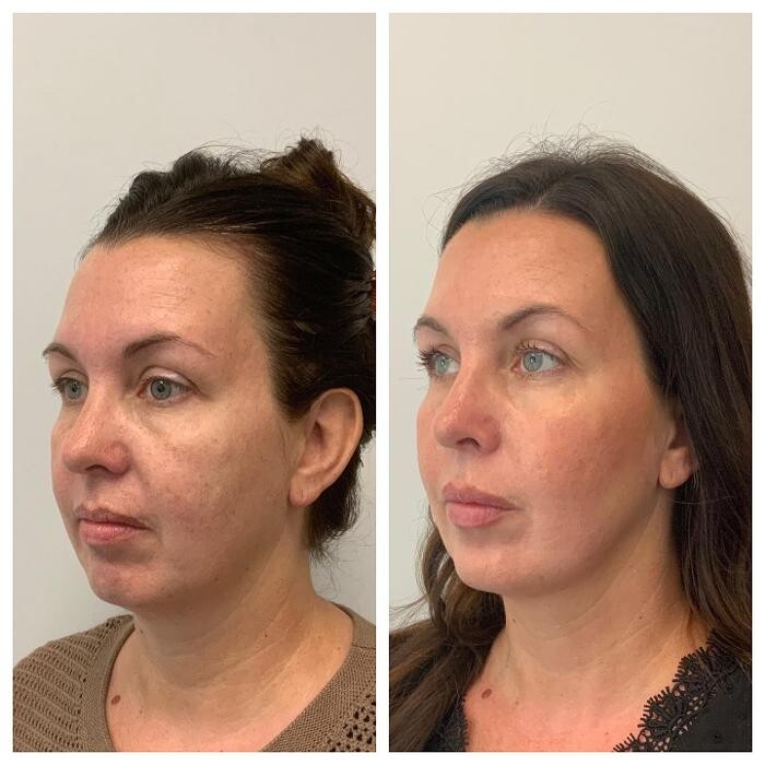 Images Glo Medspa